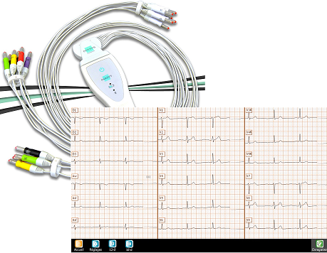 Electro-cardiogramme (ECG)